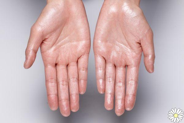 Chapped hands in winter: the best natural remedies and tips to prevent